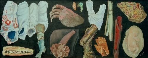 Childbirth trauma (Jindrich Styrsky) - Muzeo.com